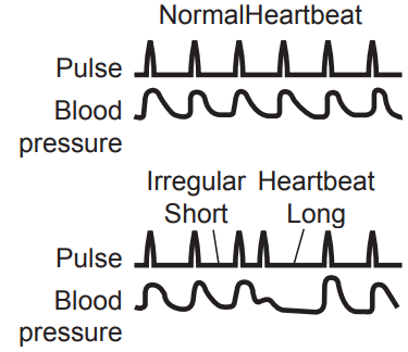 what_is_irregular_heartbeat_omron_digital_automatic_bp_monitor_hem-7113.png