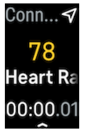 Fitbit Inspire 3 Fitness Tracker-Heart-rate signal missing A