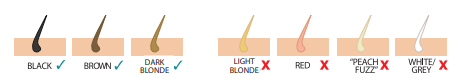Remington I-Light IPL Hair Removal IPL2000-fig-b