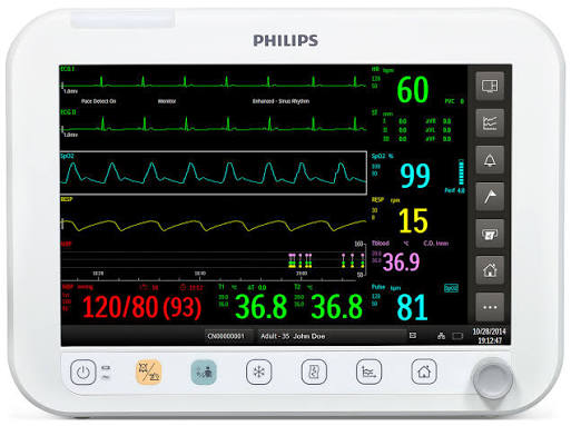 philips_efficia_cm12_patient_monitor.jpg