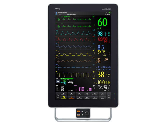 mindray_benevision_n22_patient_monitor.jpg